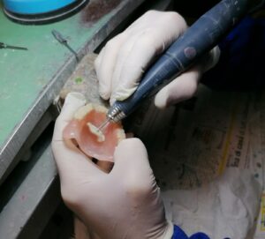 riparazioni protesi fiano romano